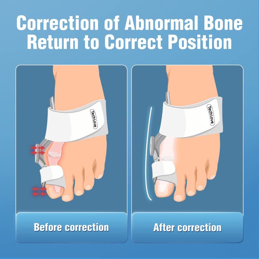 Adjustable Big Toe Bunion Corrector